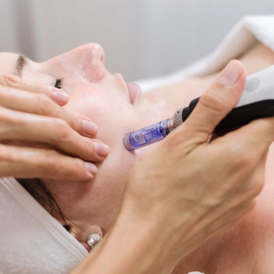 What to Expect from a Professional Microneedling Facial Treatment for Skin Rejuvenation